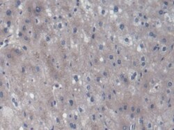 Invitrogen UCP2 Monoclonal Antibody (D7), Invitrogen 20 &mu;L; Unconjugated:Antibodies,