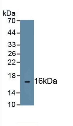Invitrogen UCP2 Monoclonal Antibody (D7), Invitrogen:Antibodies:Primary