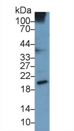 Invitrogen UCN3 Monoclonal Antibody (C9), Invitrogen:Anticorps:Anticorps