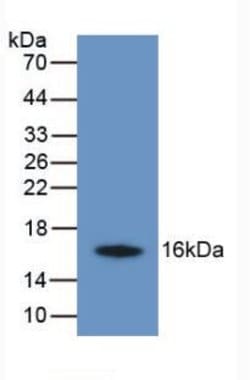 Invitrogen TMEM27 Monoclonal Antibody (C5), Invitrogen 20 &mu;L; Unconjugated:Antibodies,