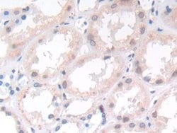 Invitrogen ST14 Monoclonal Antibody (C4), Invitrogen 20 &mu;L; Unconjugated:Antibodies,
