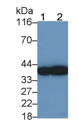 Invitrogen SFTPD Monoclonal Antibody (C4), Invitrogen 20 &mu;L | Buy Online | Invitrogen&trade; | Fisher Scientific