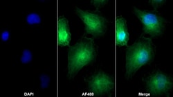 Invitrogen SFRP4 Monoclonal Antibody (5#), Invitrogen 100 &mu;L | Buy Online | Invitrogen&trade; | Fisher Scientific