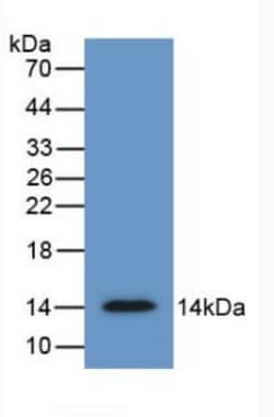 Invitrogen SFRP4 Monoclonal Antibody (5#), Invitrogen 100 &mu;L | Buy Online | Invitrogen&trade; | Fisher Scientific