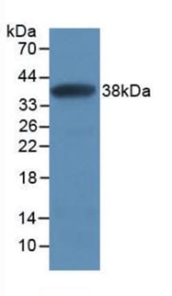 Invitrogen SFRP1 Monoclonal Antibody (C5), Invitrogen 100 &mu;L; Unconjugated:Antibodies,