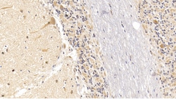 Invitrogen SEMA5B Monoclonal Antibody (C3), Invitrogen 100 &mu;L; Unconjugated:Antibodies,