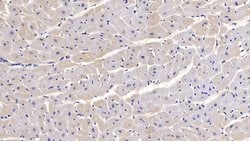 Invitrogen SEMA5B Monoclonal Antibody (C11), Invitrogen 20 &mu;L | Buy Online | Invitrogen&trade; | Fisher Scientific