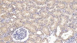 SEMA3A Monoclonal Antibody (C2), Invitrogen:Antibodies:Primary Antibodies