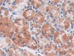S100A5 Monoclonal Antibody (C8), Invitrogen:Antibodies:Primary Antibodies