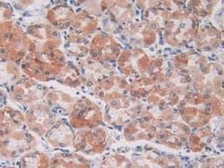 S100A5 Monoclonal Antibody (C8), Invitrogen:Antibodies:Primary Antibodies