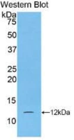 S100A5 Monoclonal Antibody (C8), Invitrogen:Antibodies:Primary Antibodies