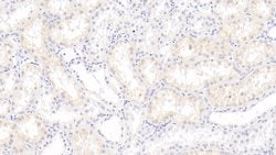 Invitrogen S100A3 Monoclonal Antibody (C5), Invitrogen 20 &mu;L; Unconjugated:Antibodies,