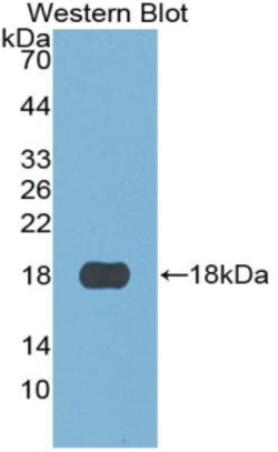 Invitrogen S100A3 Monoclonal Antibody (C5), Invitrogen 20 &mu;L; Unconjugated:Antibodies,