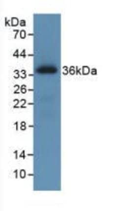 Invitrogen ROS1 Monoclonal Antibody (C1), Invitrogen 100 &mu;L | Buy Online | Invitrogen&trade; | Fisher Scientific