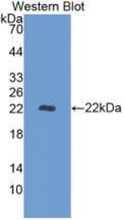 Invitrogen REV1 Monoclonal Antibody (10#), Invitrogen 100 &mu;L; Unconjugated:Antibodies,
