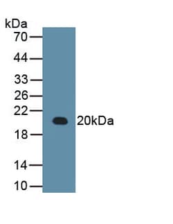 Invitrogen RARS Monoclonal Antibody (C9), Invitrogen 100 &mu;L; Unconjugated:Antibodies,