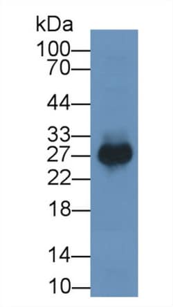 Invitrogen PTGDS Monoclonal Antibody (C2), Invitrogen 100 &mu;L; Unconjugated:Antibodies,