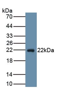 Invitrogen PTGDS Monoclonal Antibody (C2), Invitrogen 100 &mu;L; Unconjugated:Antibodies,