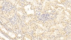 Periostin Monoclonal Antibody (C6), Invitrogen:Antibodies:Primary Antibodies