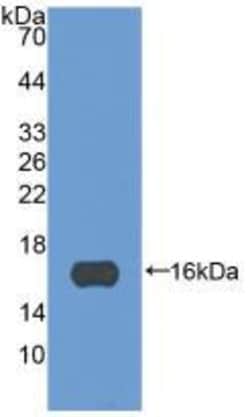 Periostin Monoclonal Antibody (C6), Invitrogen:Antibodies:Primary Antibodies