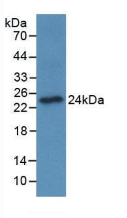 Invitrogen OSCAR Monoclonal Antibody (C2), Invitrogen 20 &mu;L; Unconjugated:Antibodies,