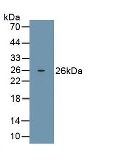 Invitrogen ORM2 Monoclonal Antibody (D1), Invitrogen 100 &mu;L; Unconjugated:Antibodies,