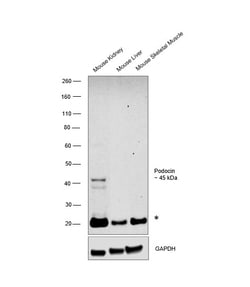 Invitrogen Podocin Monoclonal Antibody (C3), Invitrogen 20 &mu;L; Unconjugated:Antibodies,