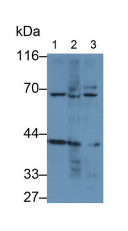 Invitrogen Mesothelin Monoclonal Antibody (C6), Invitrogen 20 &mu;L; Unconjugated:Antibodies,