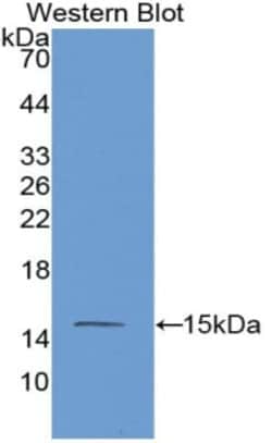 Invitrogen MASP2 Monoclonal Antibody (c5), Invitrogen 100 &mu;L; Unconjugated:Antibodies,