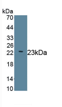 Invitrogen Laminin gamma-2 Monoclonal Antibody (D7), Invitrogen 100 &mu;L | Buy Online | Invitrogen&trade; | Fisher Scientific