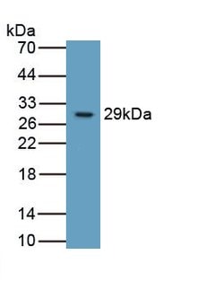 ITGB6 Monoclonal Antibody (C5), Invitrogen:Antibodies:Primary Antibodies