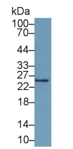 Invitrogen Interferon alpha-21 Monoclonal Antibody (d4), Invitrogen 20