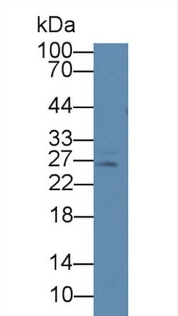 Invitrogen Prolactin Monoclonal Antibody (C13), Invitrogen 100 &mu;L; Unconjugated:Antibodies,