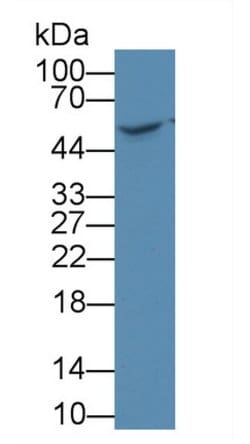 NAMPT Monoclonal Antibody (D1), Invitrogen:Antibodies:Primary Antibodies