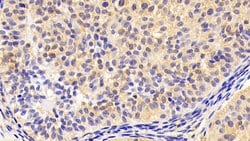 INHA Monoclonal Antibody (C1), Invitrogen:Antibodies:Primary Antibodies