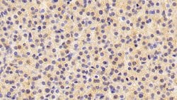 INHA Monoclonal Antibody (C1), Invitrogen:Antibodies:Primary Antibodies