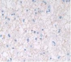 Invitrogen IL-28A Monoclonal Antibody (C11), Invitrogen 20 &mu;L | Buy Online | Invitrogen&trade; | Fisher Scientific