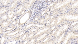 Invitrogen IL-18 Monoclonal Antibody (C10), Invitrogen 100 &mu;L; Unconjugated:Antibodies,