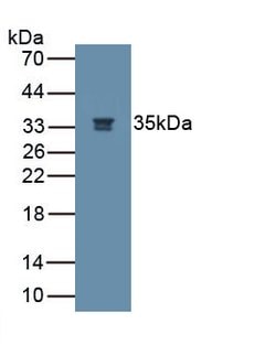 Podocin Monoclonal Antibody (C3), Invitrogen:Antibodies:Primary Antibodies
