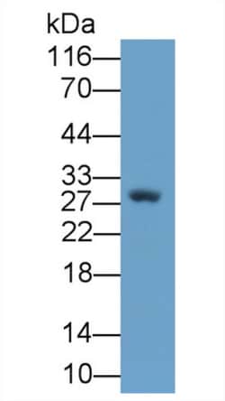 Invitrogen NGF Monoclonal Antibody (C13), Invitrogen 100 &mu;L; Unconjugated:Antibodies,