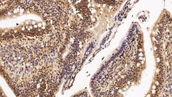 HDAC1 Monoclonal Antibody (E22), Invitrogen:Antibodies:Primary Antibodies