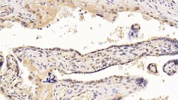 Invitrogen HDAC1 Monoclonal Antibody (E22), Invitrogen 20 &mu;L; Unconjugated:Antibodies,