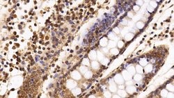 HDAC1 Monoclonal Antibody (E22), Invitrogen:Antibodies:Primary Antibodies