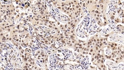 Invitrogen HDAC1 Monoclonal Antibody (E22), Invitrogen 20 &mu;L; Unconjugated:Antibodies,
