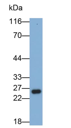Invitrogen GSTA1 Monoclonal Antibody (2-2#), Invitrogen 100 &mu;L; Unconjugated:Antibodies,