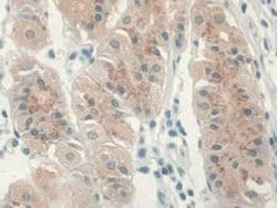 Invitrogen GREM1 Monoclonal Antibody (C1), Invitrogen 100 &mu;L; Unconjugated:Antibodies,