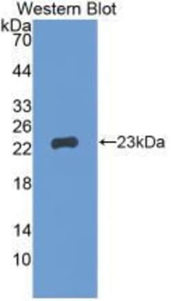 Invitrogen GREM1 Monoclonal Antibody (C1), Invitrogen 100 &mu;L; Unconjugated:Antibodies,