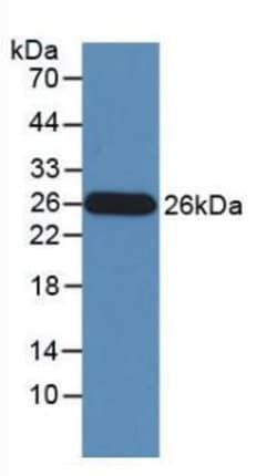Invitrogen Granzyme M Monoclonal Antibody (D1), Invitrogen 100 &mu;L | Buy Online | Invitrogen&trade; | Fisher Scientific