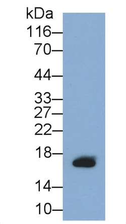 Invitrogen GIP Monoclonal Antibody (A2), Invitrogen 100 &mu;L | Buy Online | Invitrogen&trade; | Fisher Scientific