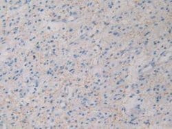 GHRH Monoclonal Antibody (C2), Invitrogen:Antibodies:Primary Antibodies